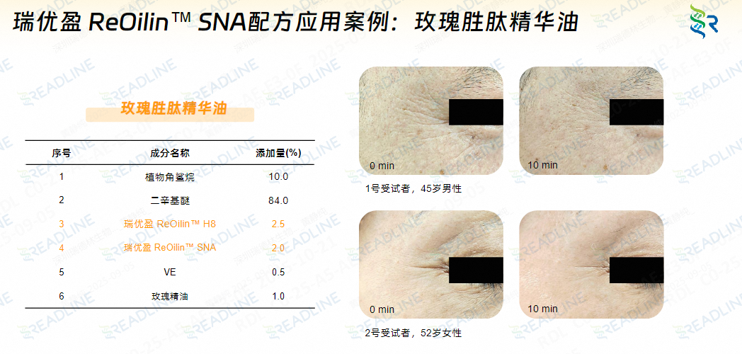 抗皱特长生报到!瑞德林类蛇毒肽获国家发明专利授权 抗皱特长生报到!瑞德林类蛇毒肽获国家发明专利授权